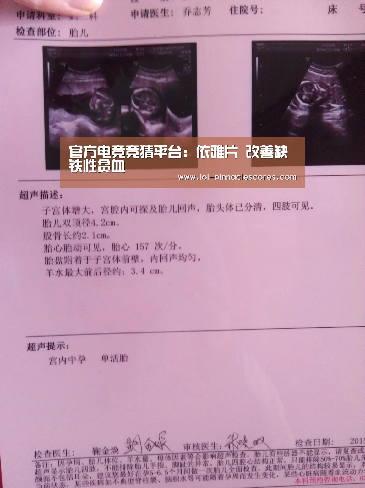 官方电竞竞猜平台:依雅片 改善缺铁性贫血(图1) LOL英雄联盟投注