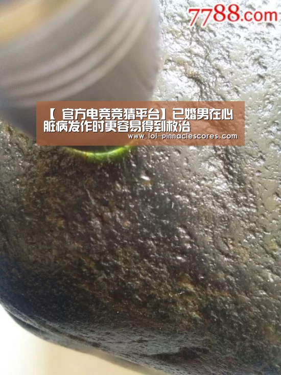 【 官方电竞竞猜平台】已婚男在心脏病发作时更容易得到救治(图2) LOL英雄联盟投注